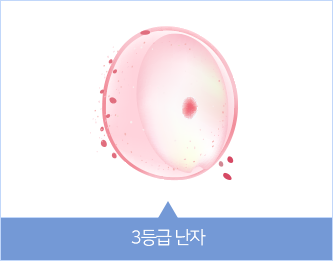 3등급 난자