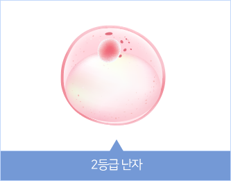 2등급 난자